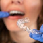 Aparelho dentário invisível odontológico: sorriso alinhado sem metal