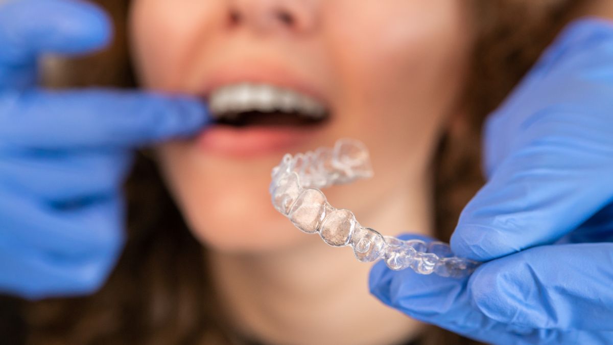 Leia mais sobre o artigo Aparelho dentário invisível odontológico: sorriso alinhado sem metal